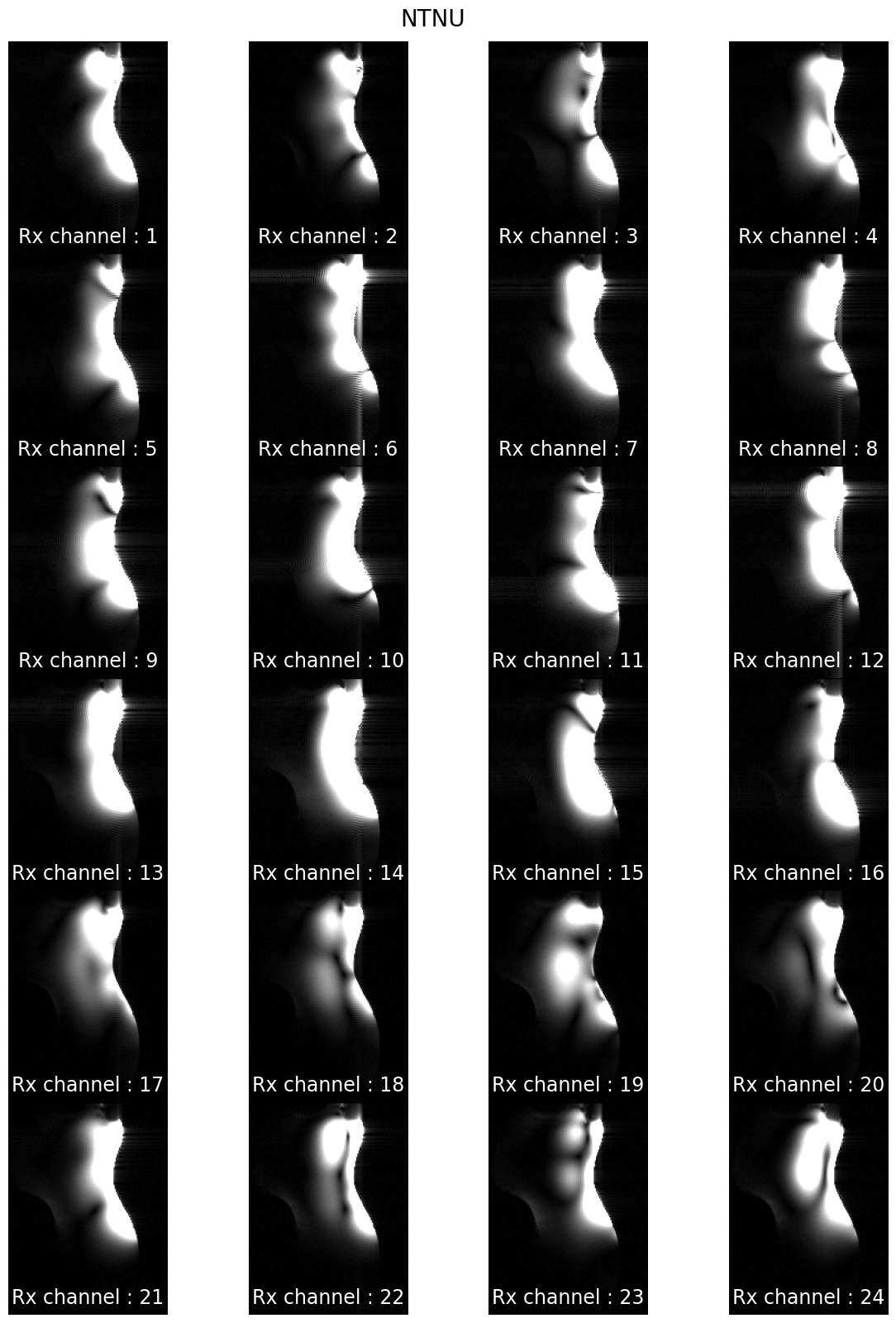 _images/6474863ab4f26c02ab8a3a39dfc9aa0e1c32dd31bc1e996004b4795d1d44d939.png